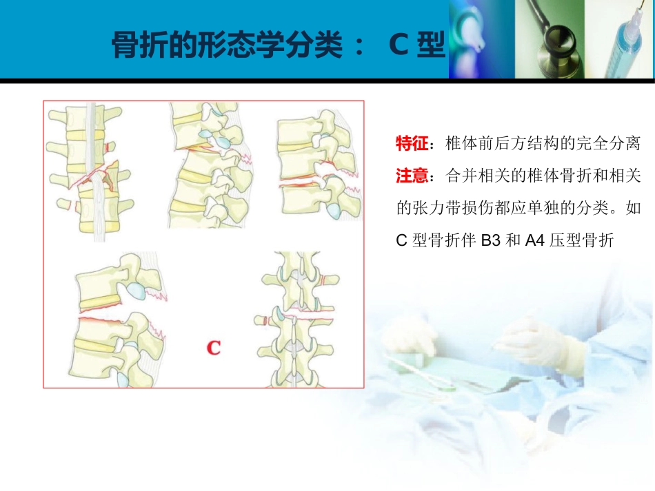 外科学：胸腰椎损伤分型_第13页