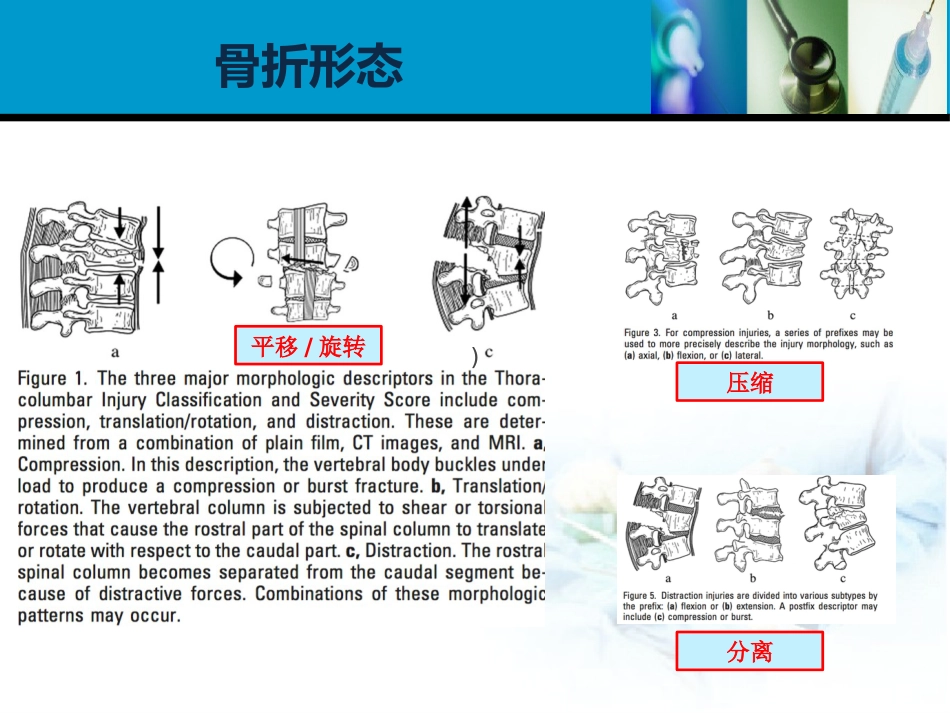 外科学：胸腰椎损伤分型_第6页