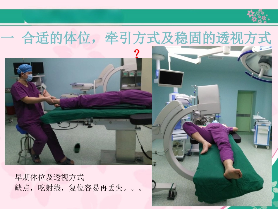外科学：股骨近端骨折的几个感悟_第2页