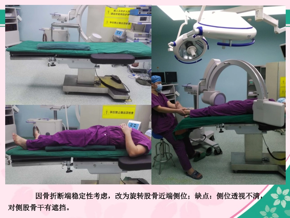 外科学：股骨近端骨折的几个感悟_第3页