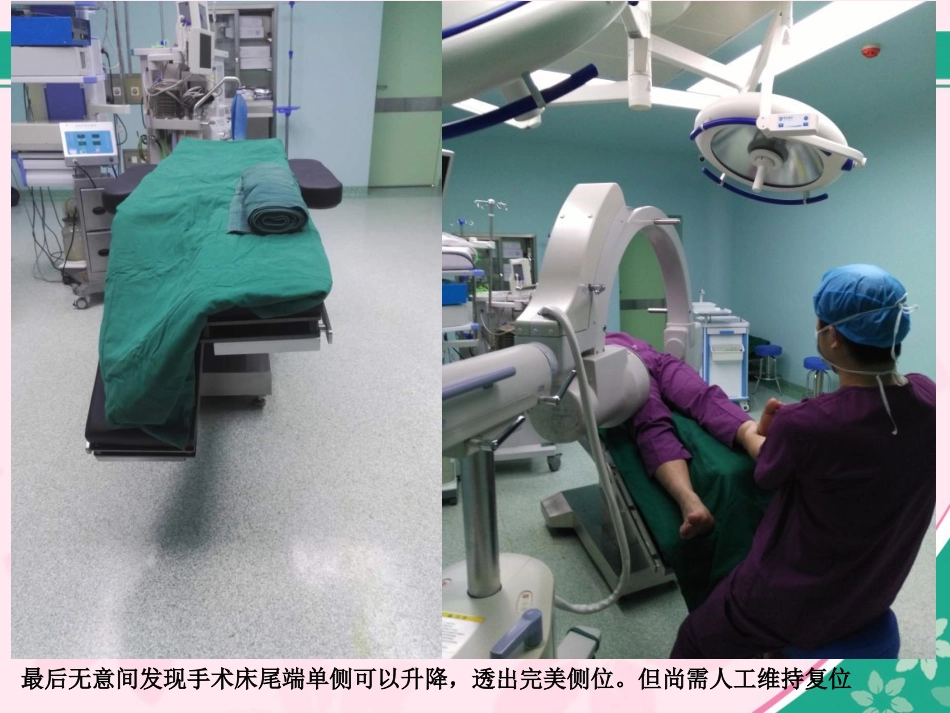 外科学：股骨近端骨折的几个感悟_第4页