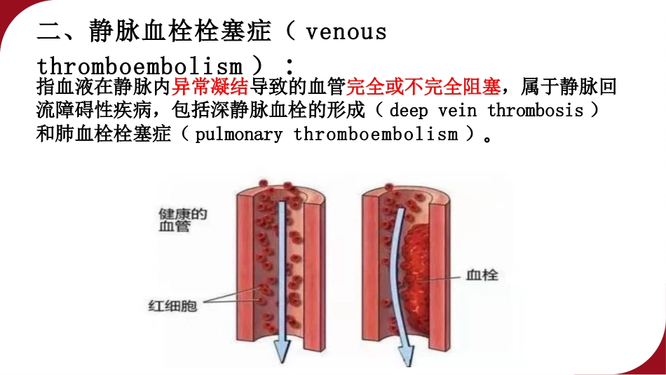 成人住院患者静脉血栓栓塞症的预防护理ppt课件_第4页