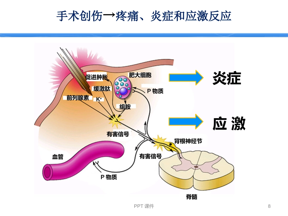 ERAS加速康复外科--ppt课件_第8页