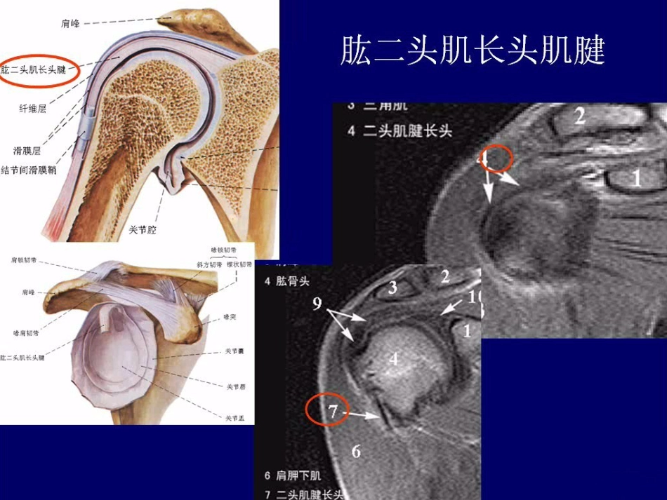 外科学：肩关节MR_第10页