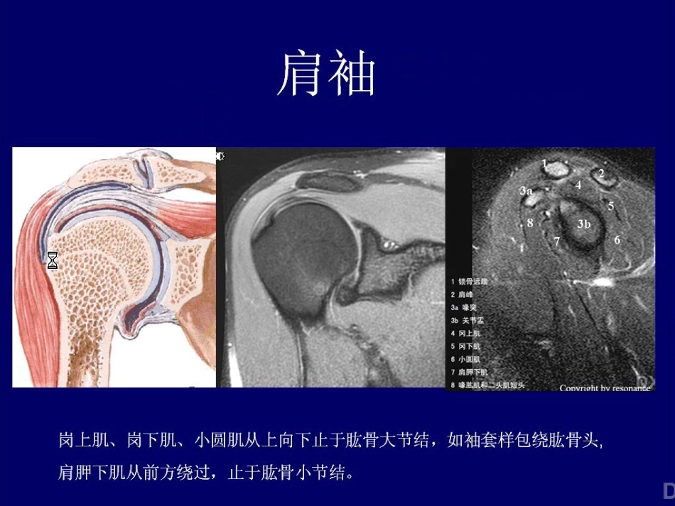 外科学：肩关节MR_第3页