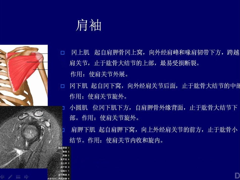 外科学：肩关节MR_第4页