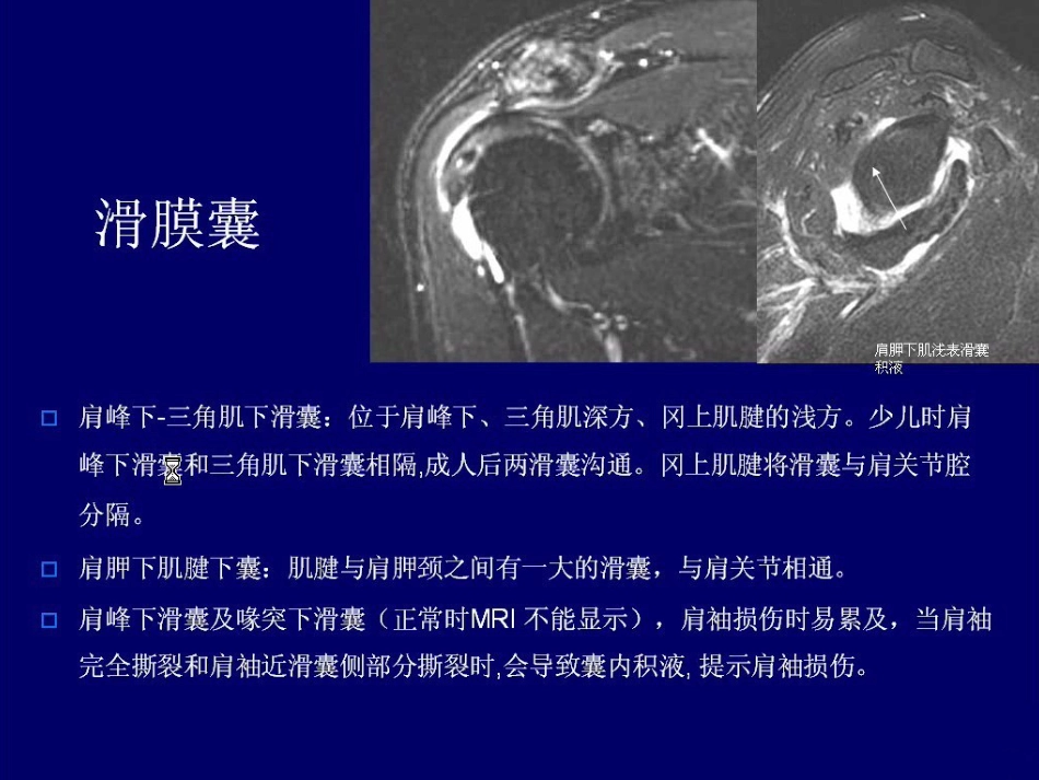 外科学：肩关节MR_第8页