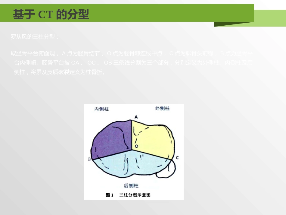 外科学：胫骨平台骨折分型_第14页