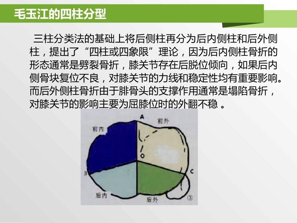 外科学：胫骨平台骨折分型_第15页