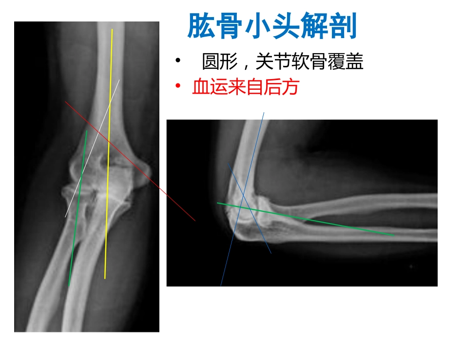 外科学：肱骨小头骨折的手术技巧_第2页