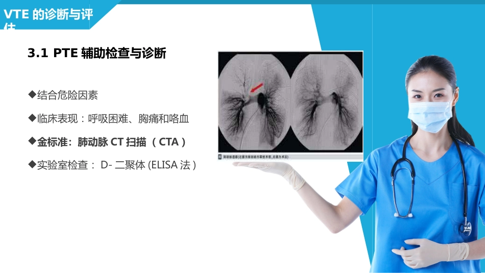 静脉血栓栓塞症（VTE）的诊断和治疗_第14页