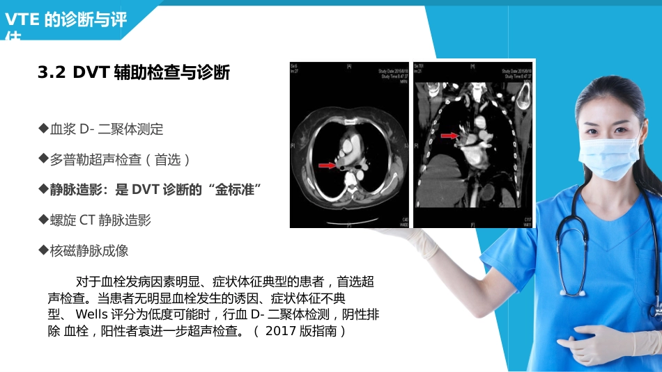 静脉血栓栓塞症（VTE）的诊断和治疗_第15页