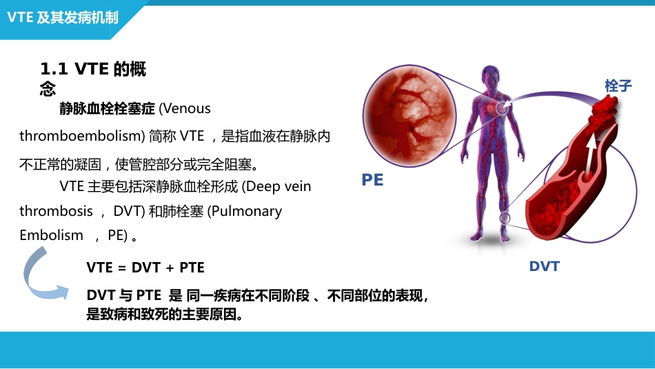 静脉血栓栓塞症（VTE）的诊断和治疗_第5页