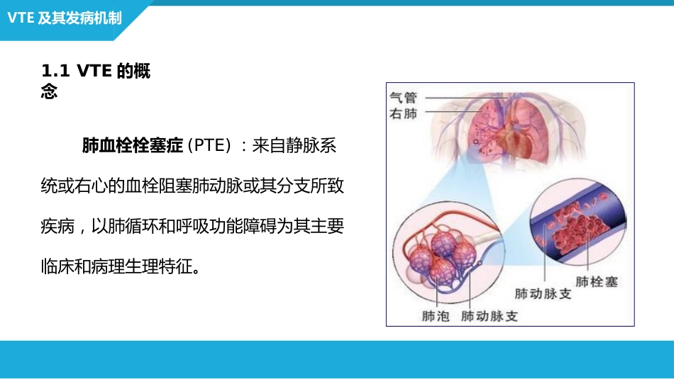 静脉血栓栓塞症（VTE）的诊断和治疗_第6页