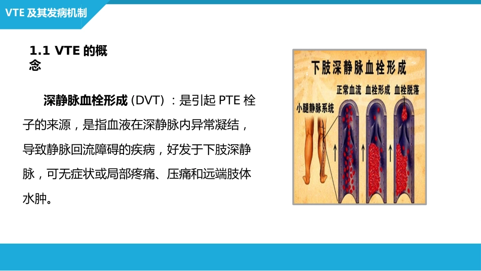静脉血栓栓塞症（VTE）的诊断和治疗_第7页