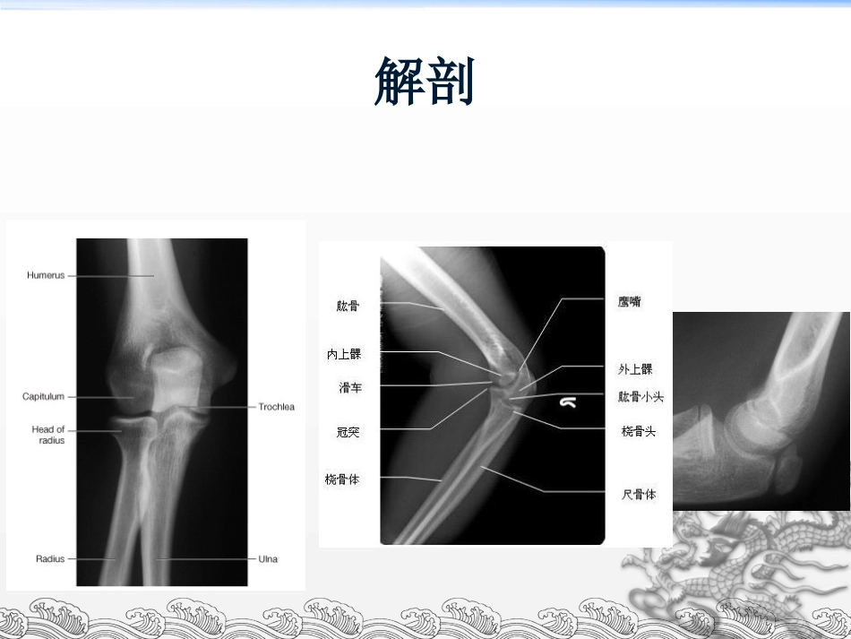 外科学：尺骨鹰嘴骨折_第6页