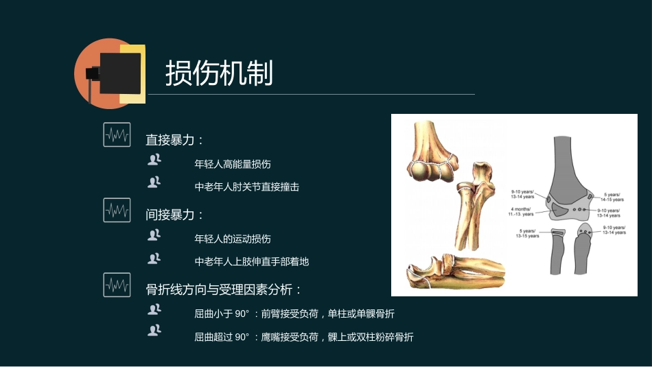 外科学：肱骨远端骨折_第12页
