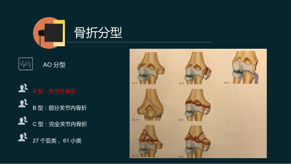 外科学：肱骨远端骨折_第15页