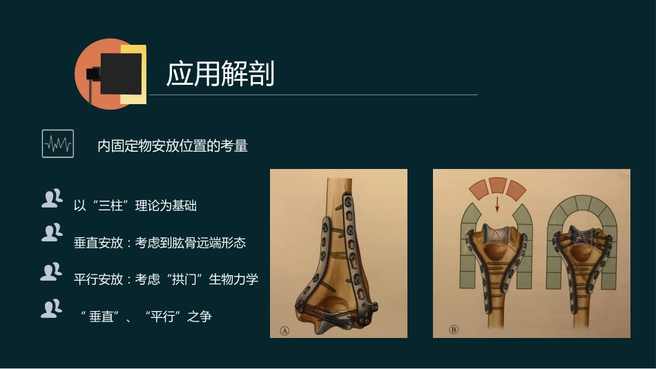外科学：肱骨远端骨折_第7页