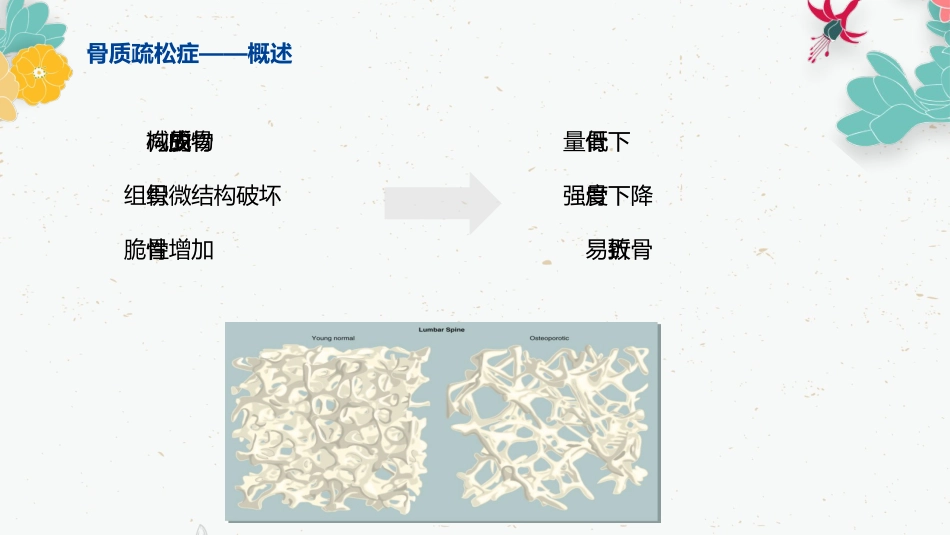 骨质疏松的药物治疗_第6页