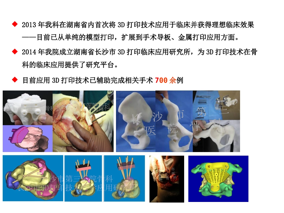 外科学：3D打印技术在骨科临床的应用_第6页