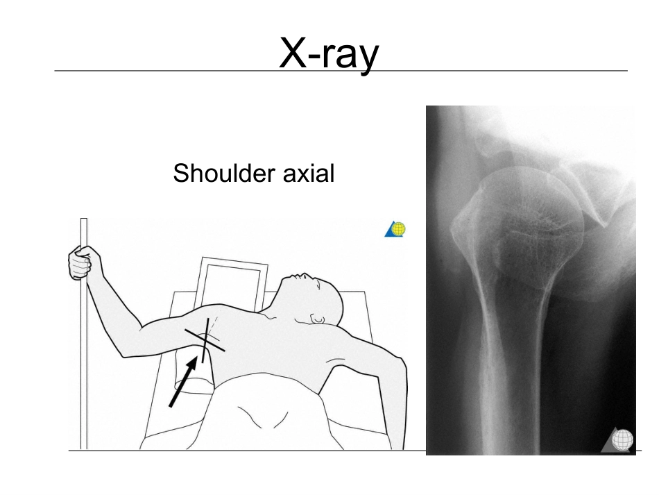 外科学：肱骨近端骨折的诊治_第11页