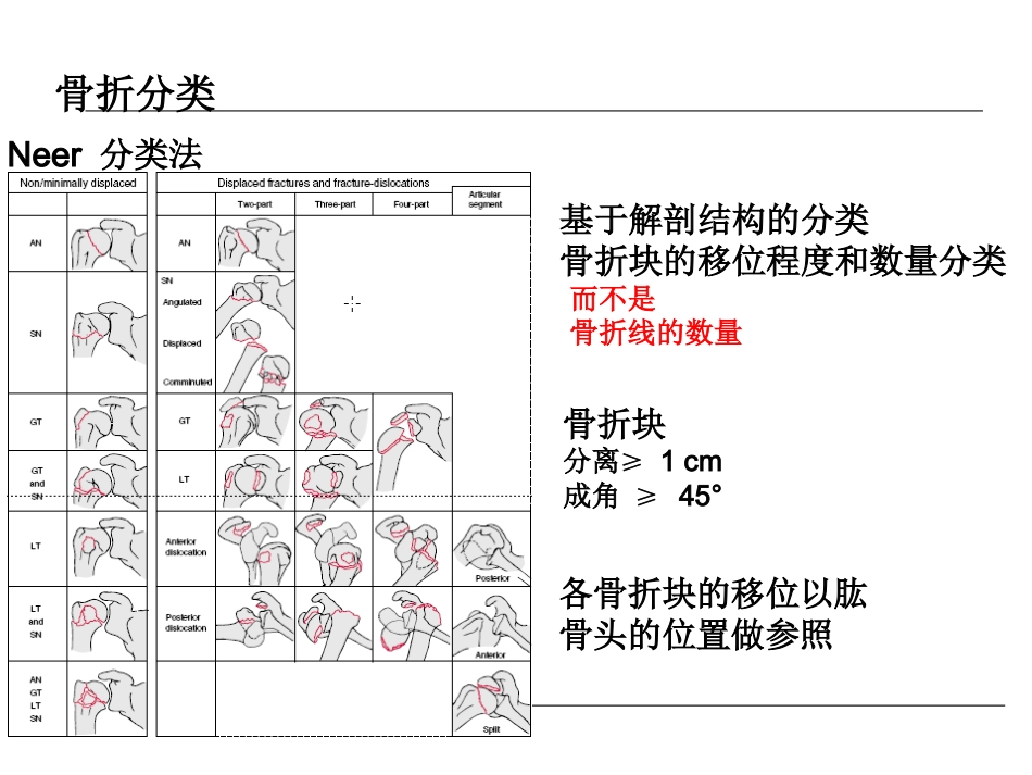外科学：肱骨近端骨折的诊治_第14页