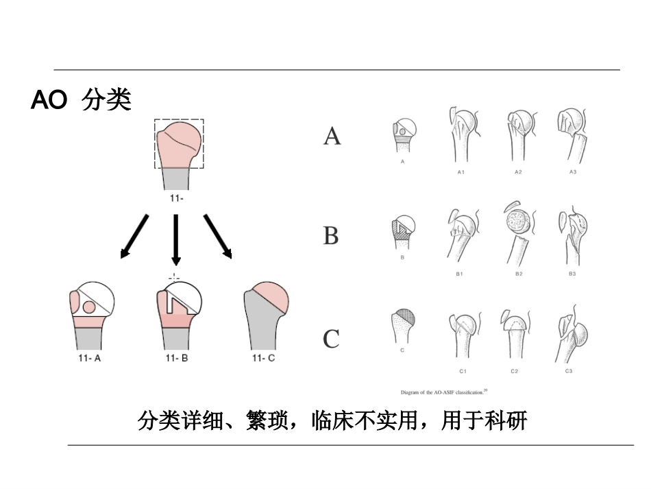 外科学：肱骨近端骨折的诊治_第15页