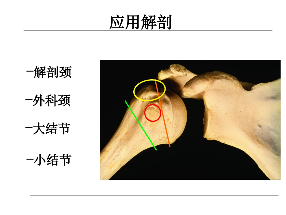 外科学：肱骨近端骨折的诊治_第4页