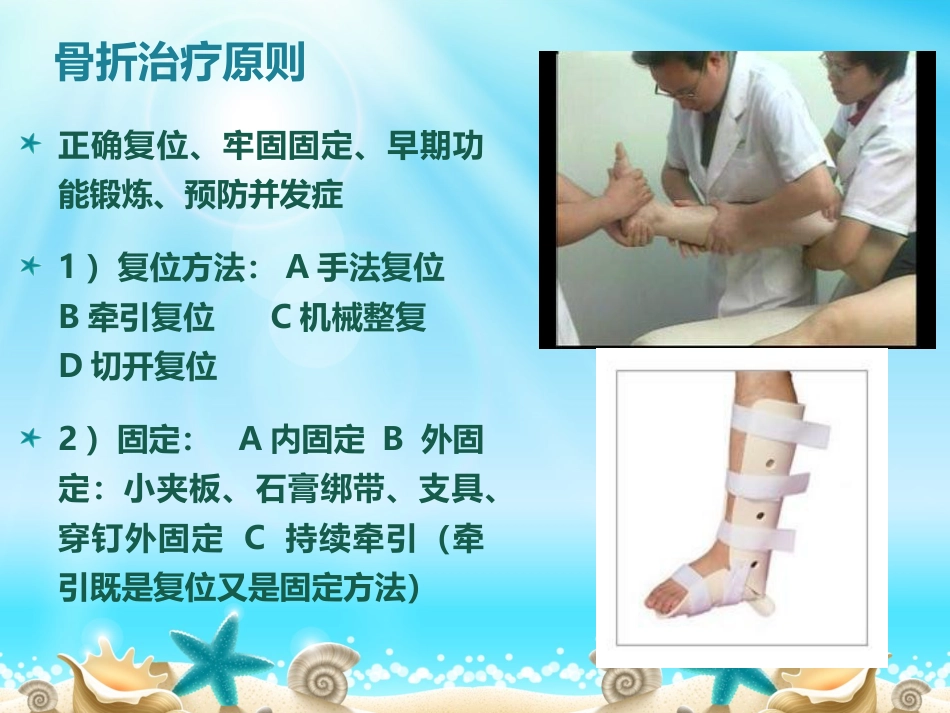外科学：胫腓骨骨折分型_第14页