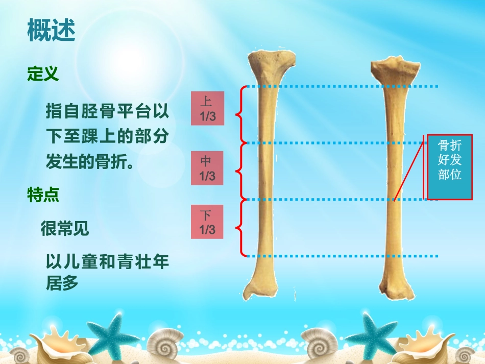 外科学：胫腓骨骨折分型_第7页