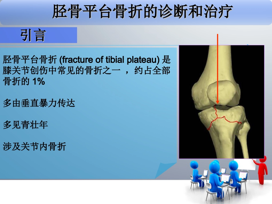 外科学：胫骨平台骨折_第3页