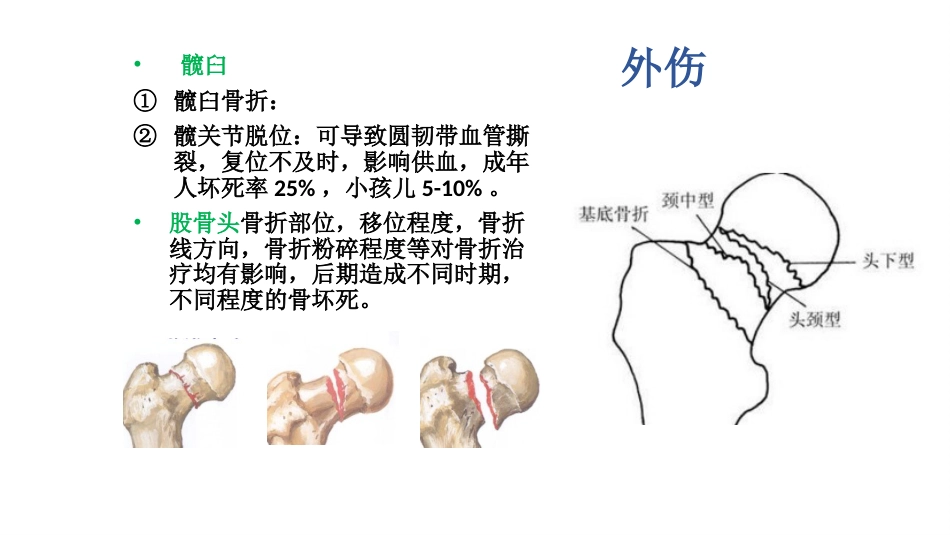 外科学：股骨头坏死_第10页