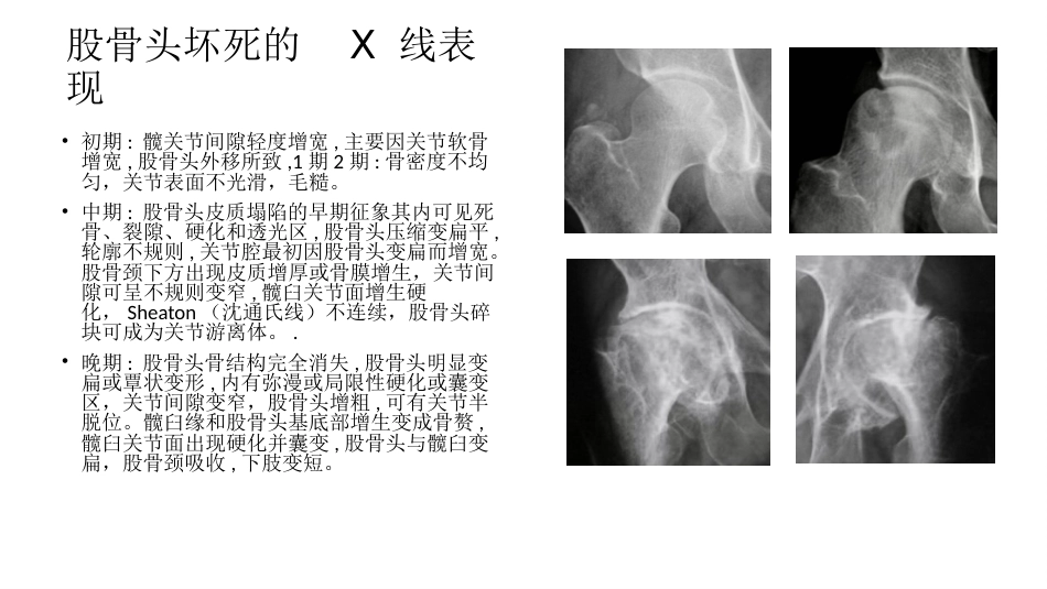 外科学：股骨头坏死_第7页