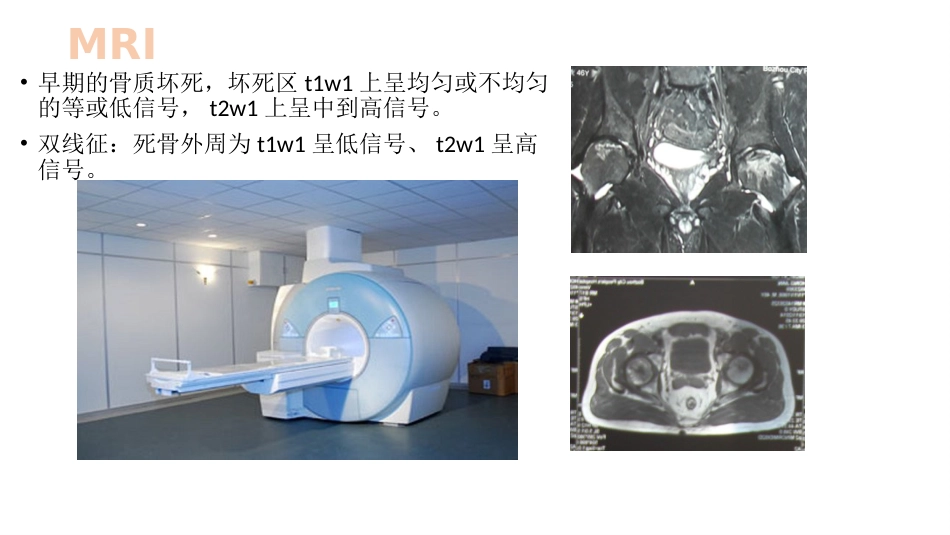 外科学：股骨头坏死_第9页