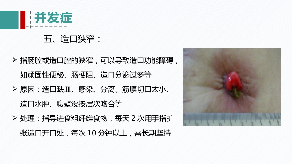 肠造口患者的病例讨论_第15页