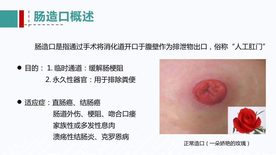 肠造口患者的病例讨论_第8页