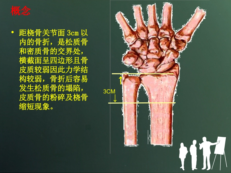 外科学：桡骨远端骨折分型_第4页