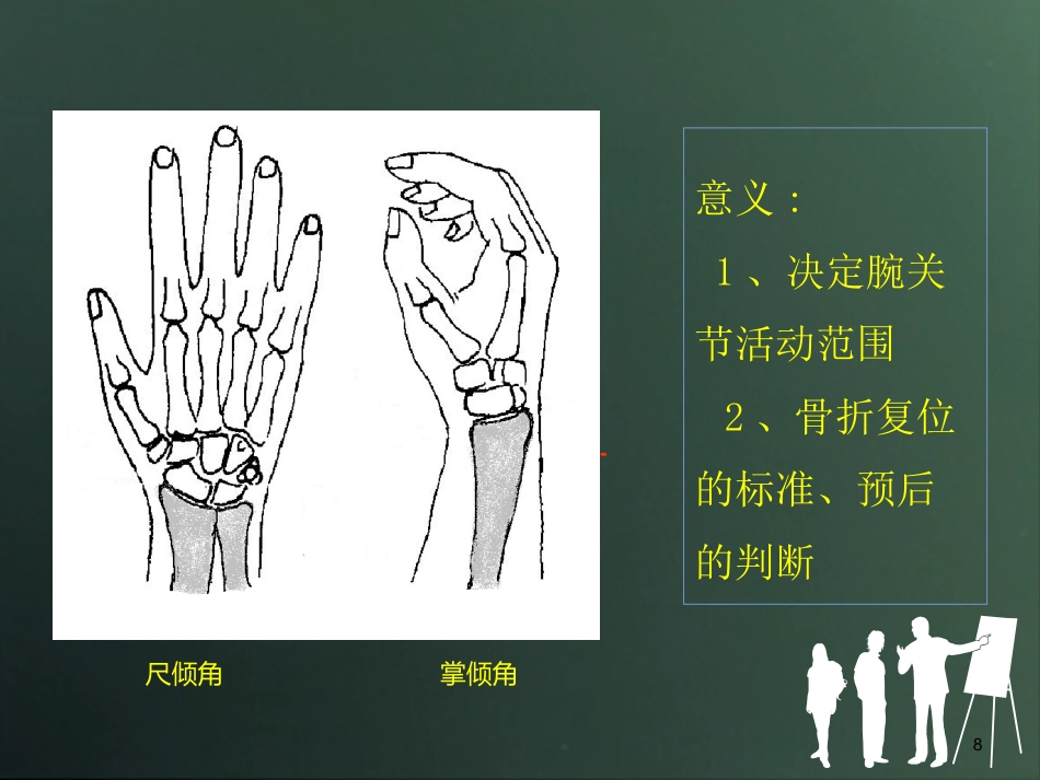 外科学：桡骨远端骨折分型_第8页