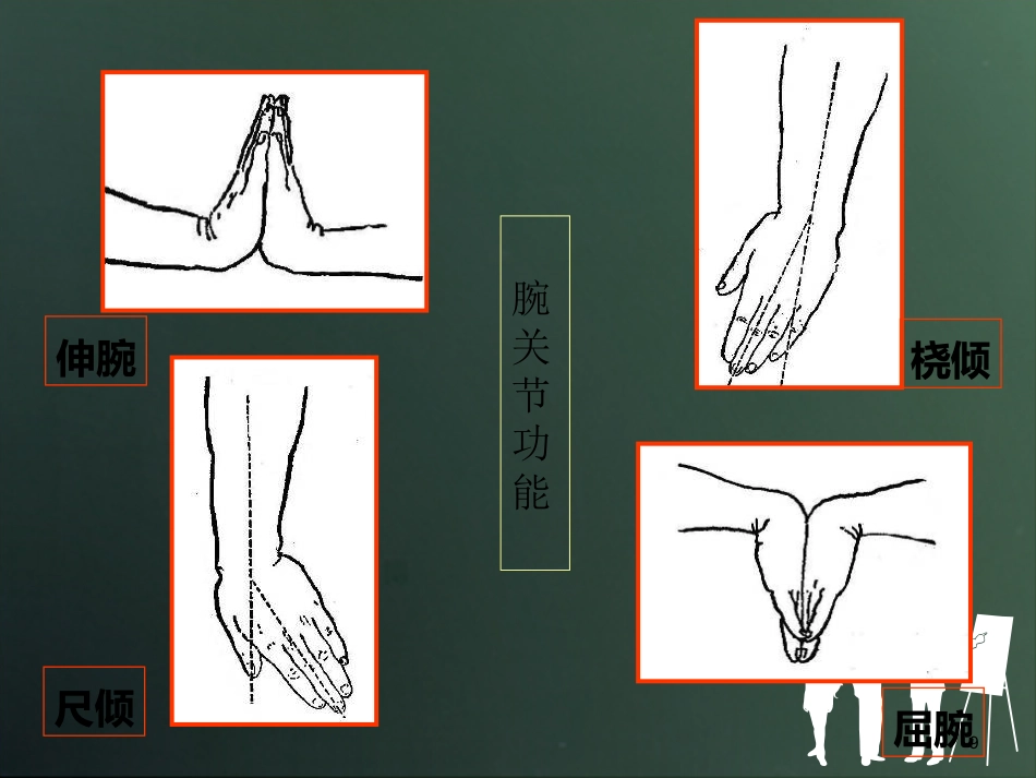 外科学：桡骨远端骨折分型_第9页