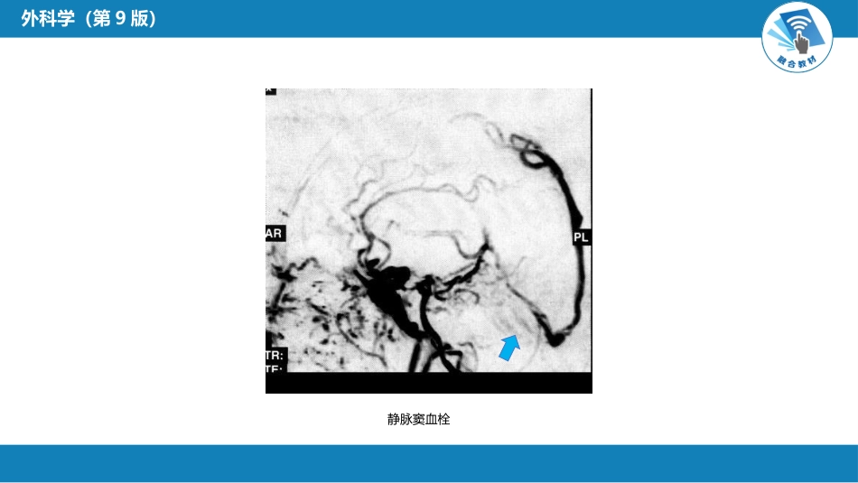 外科学：颅内压增高和脑疝_第15页
