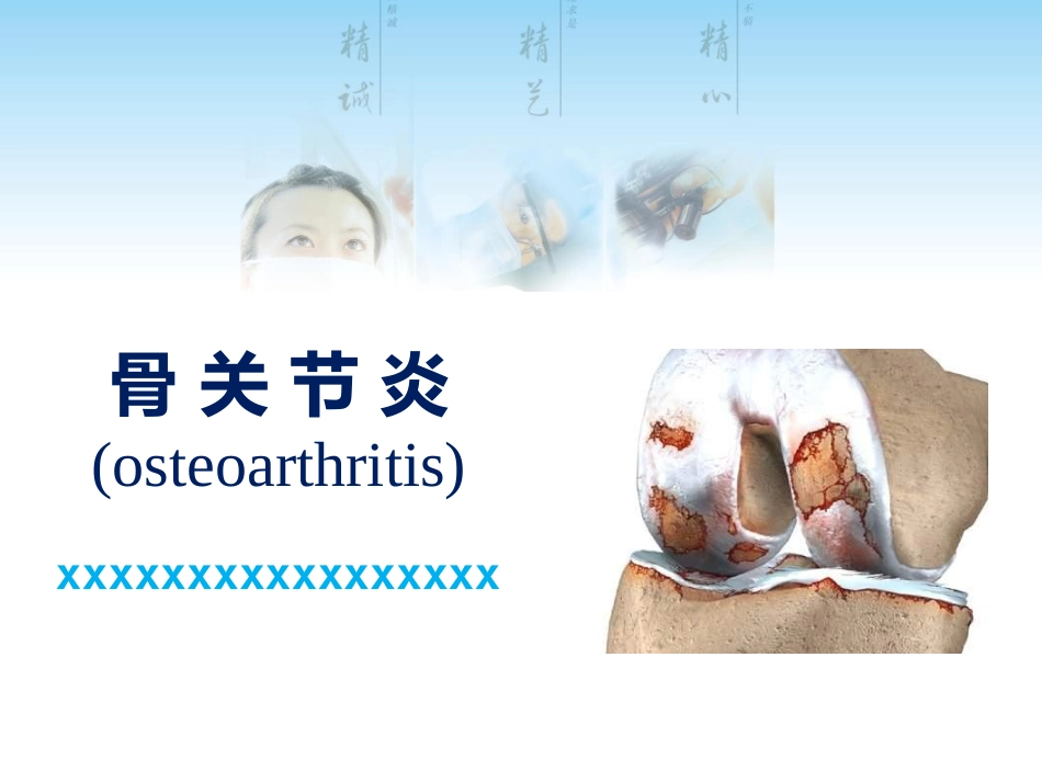 骨关节炎用药科内讲课用_第1页