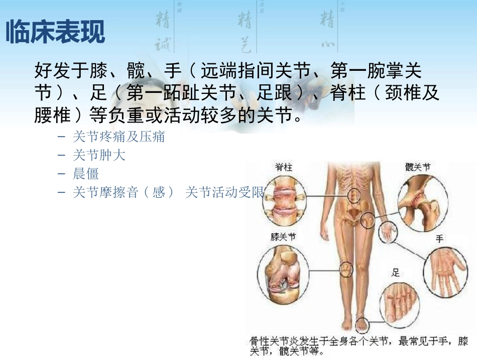 骨关节炎用药科内讲课用_第12页