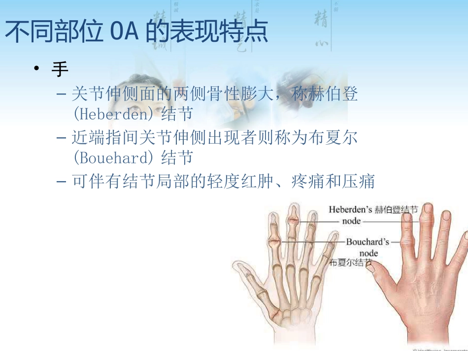 骨关节炎用药科内讲课用_第13页