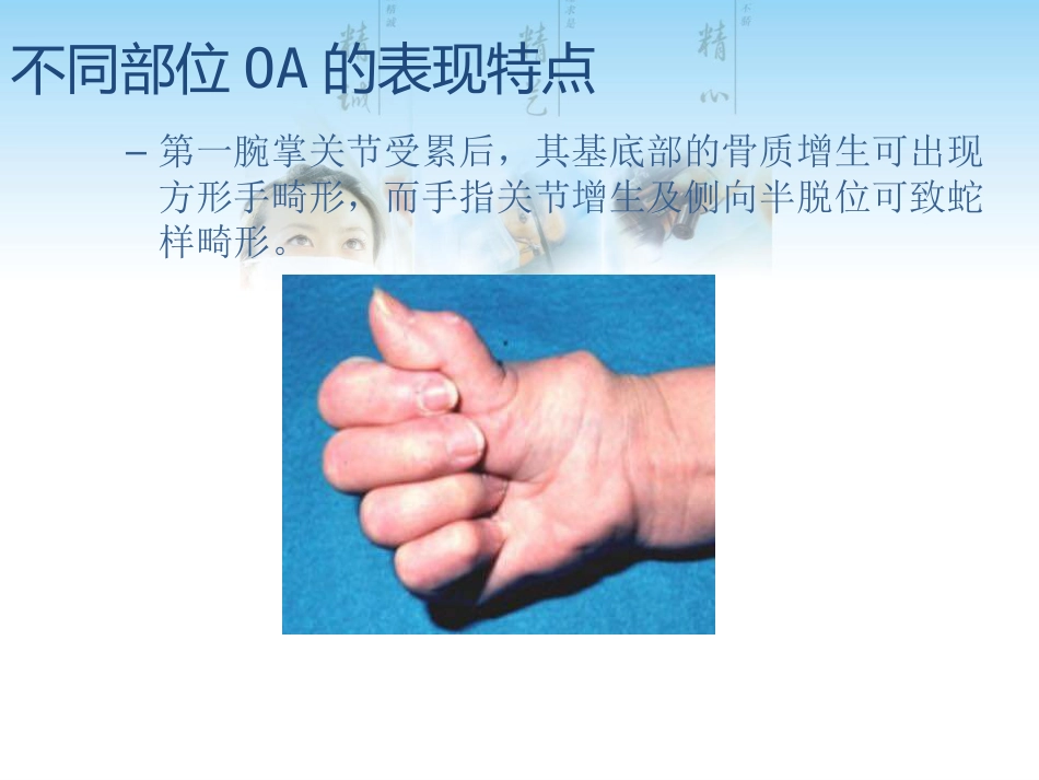 骨关节炎用药科内讲课用_第14页