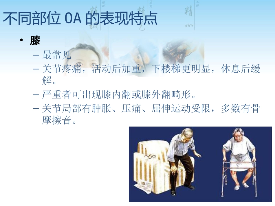 骨关节炎用药科内讲课用_第15页