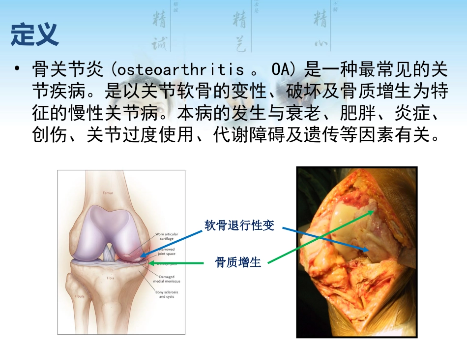 骨关节炎用药科内讲课用_第3页