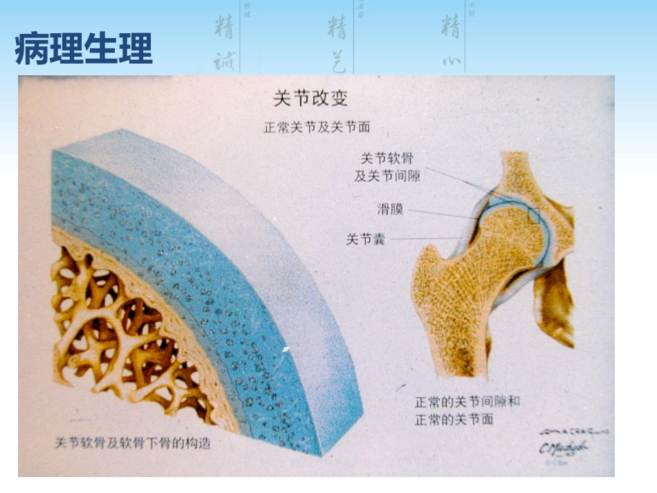 骨关节炎用药科内讲课用_第7页