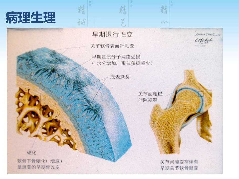 骨关节炎用药科内讲课用_第8页