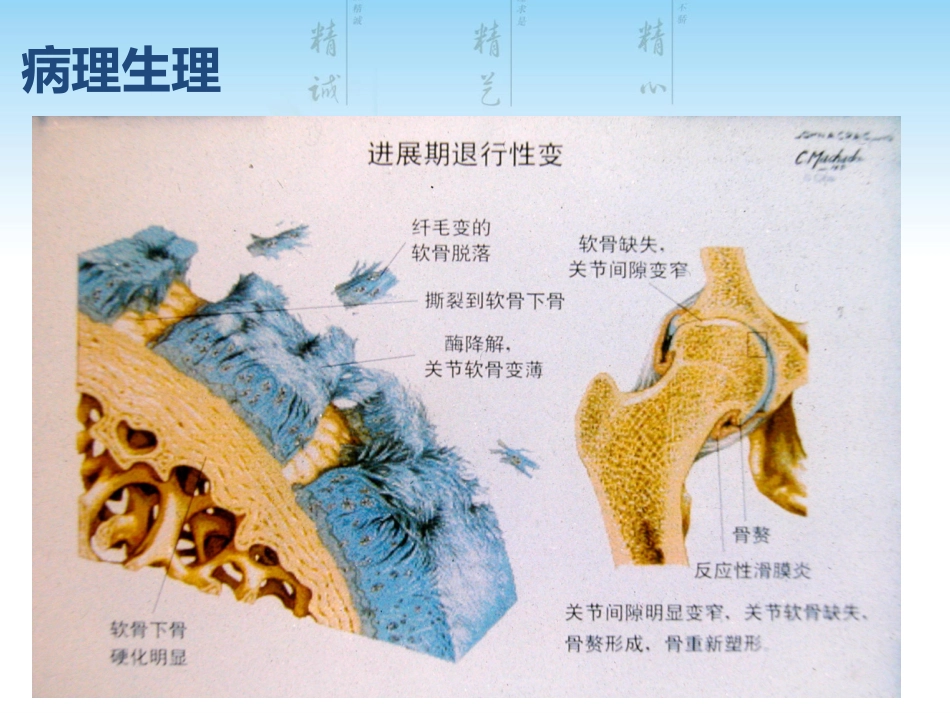 骨关节炎用药科内讲课用_第9页